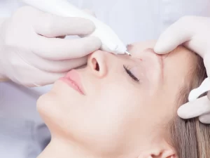 Odstranění kožních výrůstků: hemangiomů, fibrom či milií