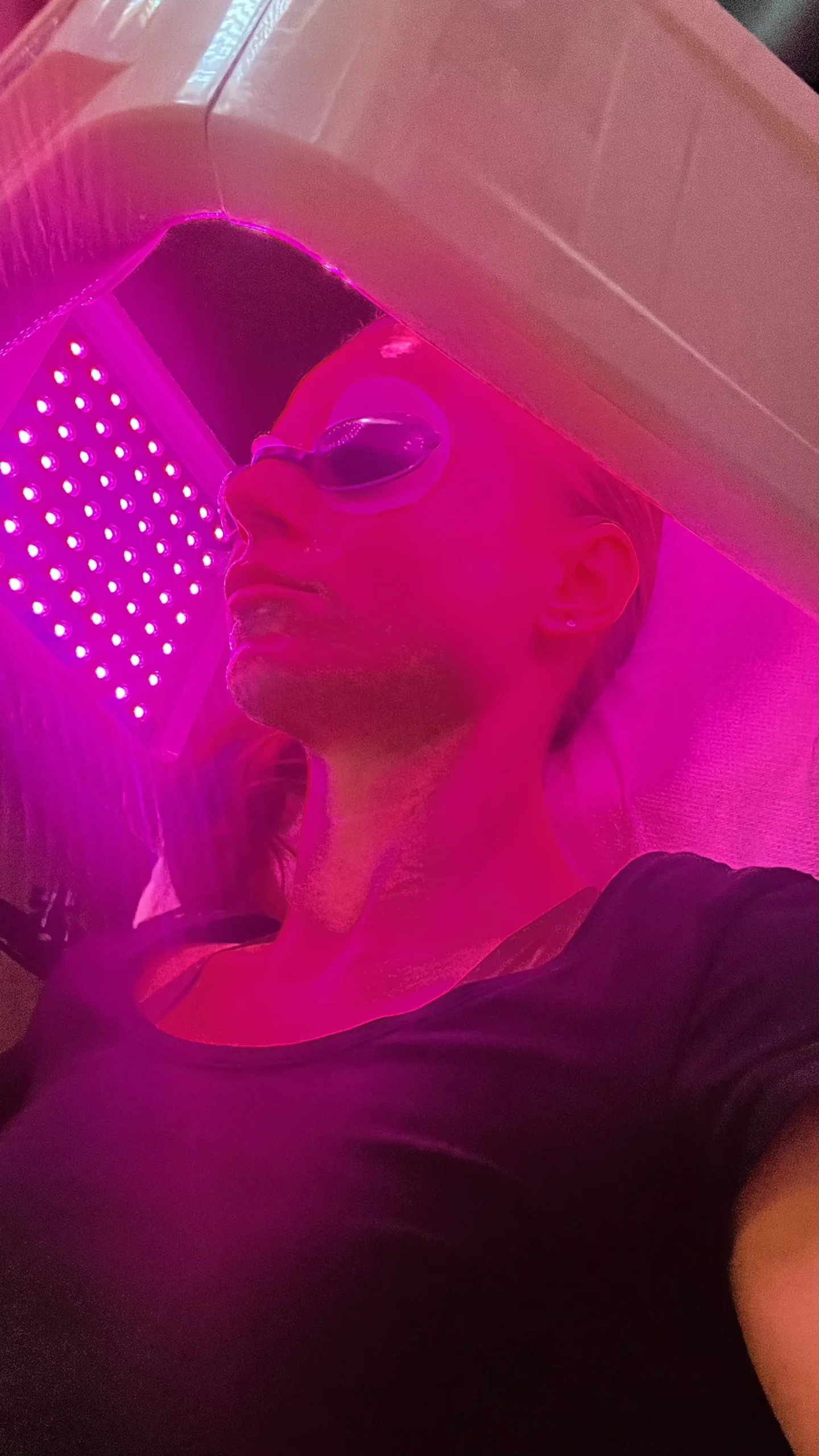 Kosmetické ošetření: ozonizér, světelná terapie i masáž - Obrázek 8