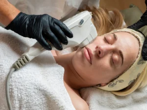 Neinvazivní facelifting intenzivním ultrazvukem HIFU