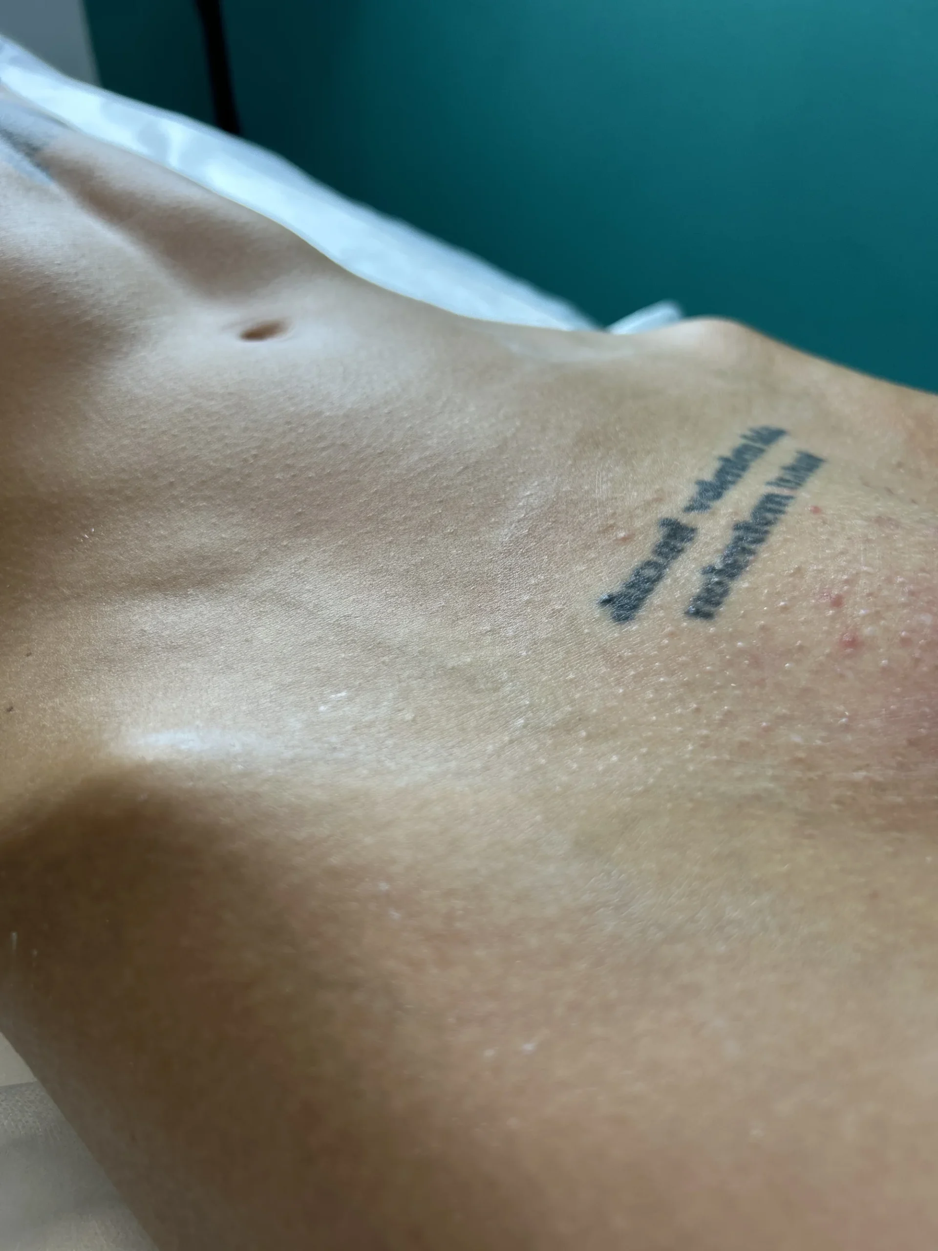 Depilace cukrovou pastou pro ženy i muže - Obrázek 8