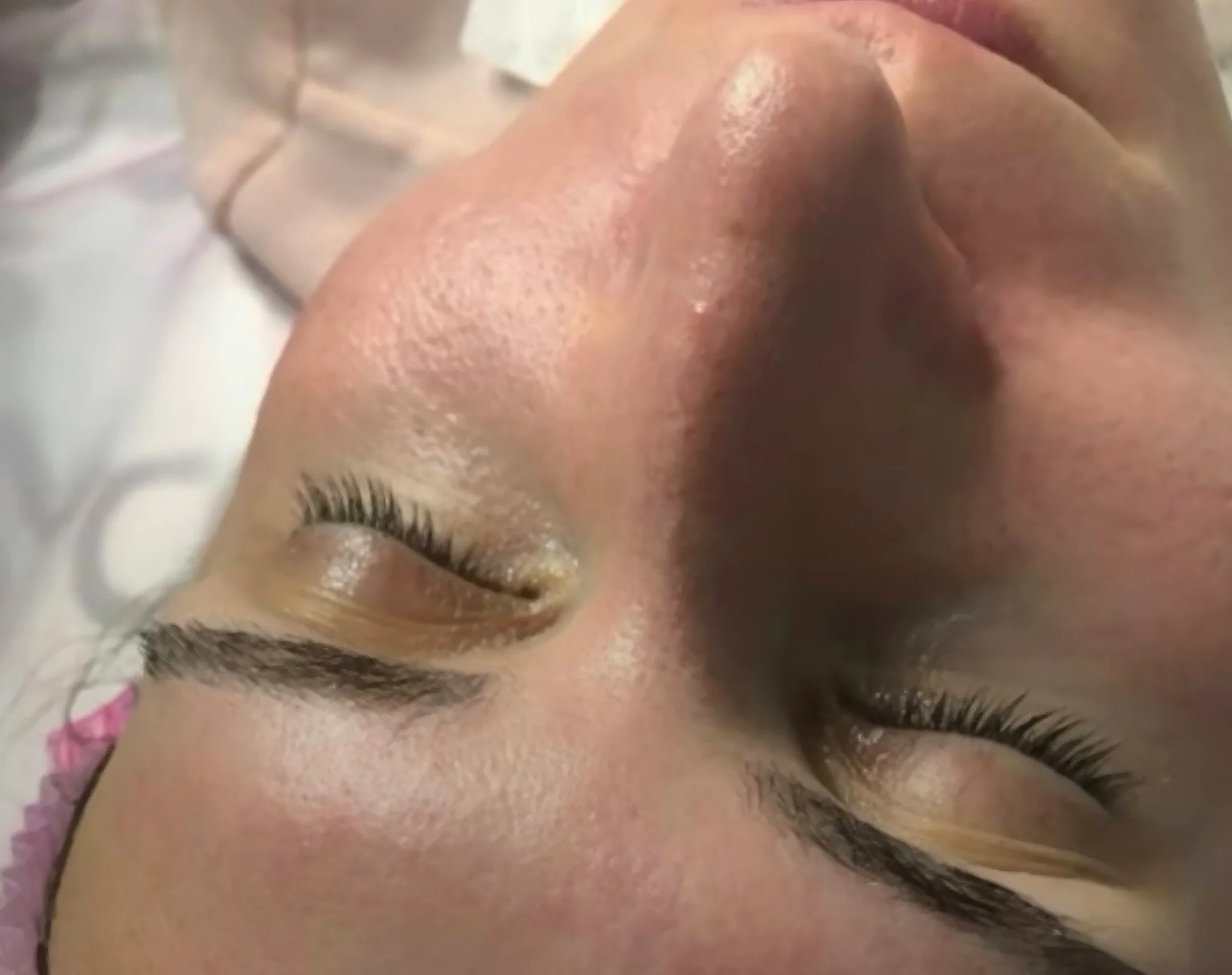 Kosmetické balíčky: hloubkové čištění pleti či peeling - Obrázek 5