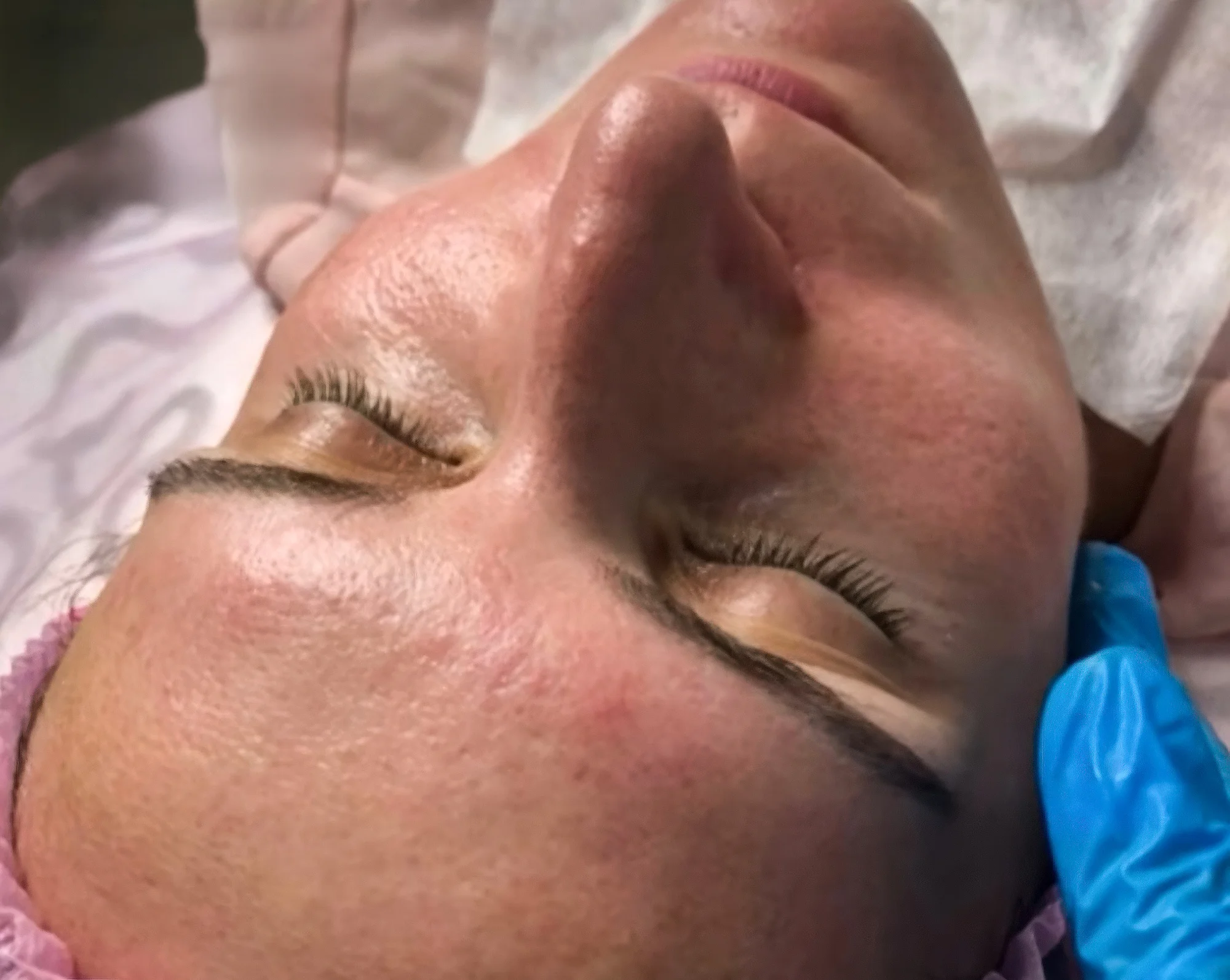 Kosmetické balíčky: hloubkové čištění pleti či peeling - Obrázek 4