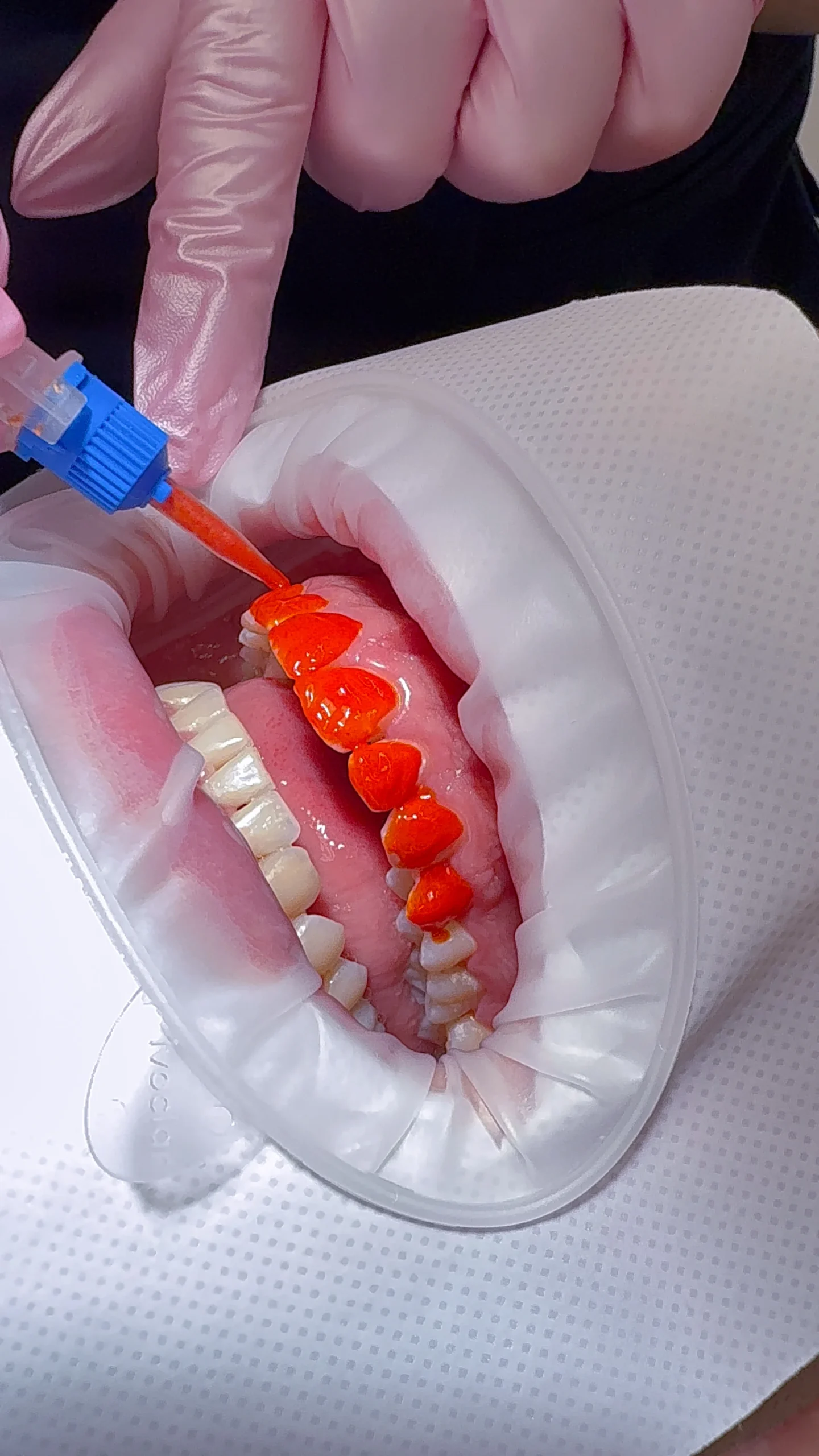 Vstupní dentální hygiena i bělení zubů, 60–120 minut - Obrázek 8