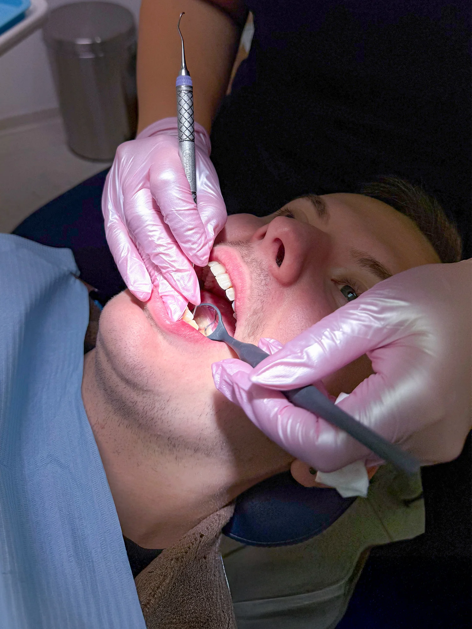 Vstupní dentální hygiena i bělení zubů, 60–120 minut - Obrázek 5