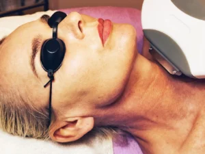 Fotorejuvenace: neinvazivní a bezbolestné omlazení pokožky