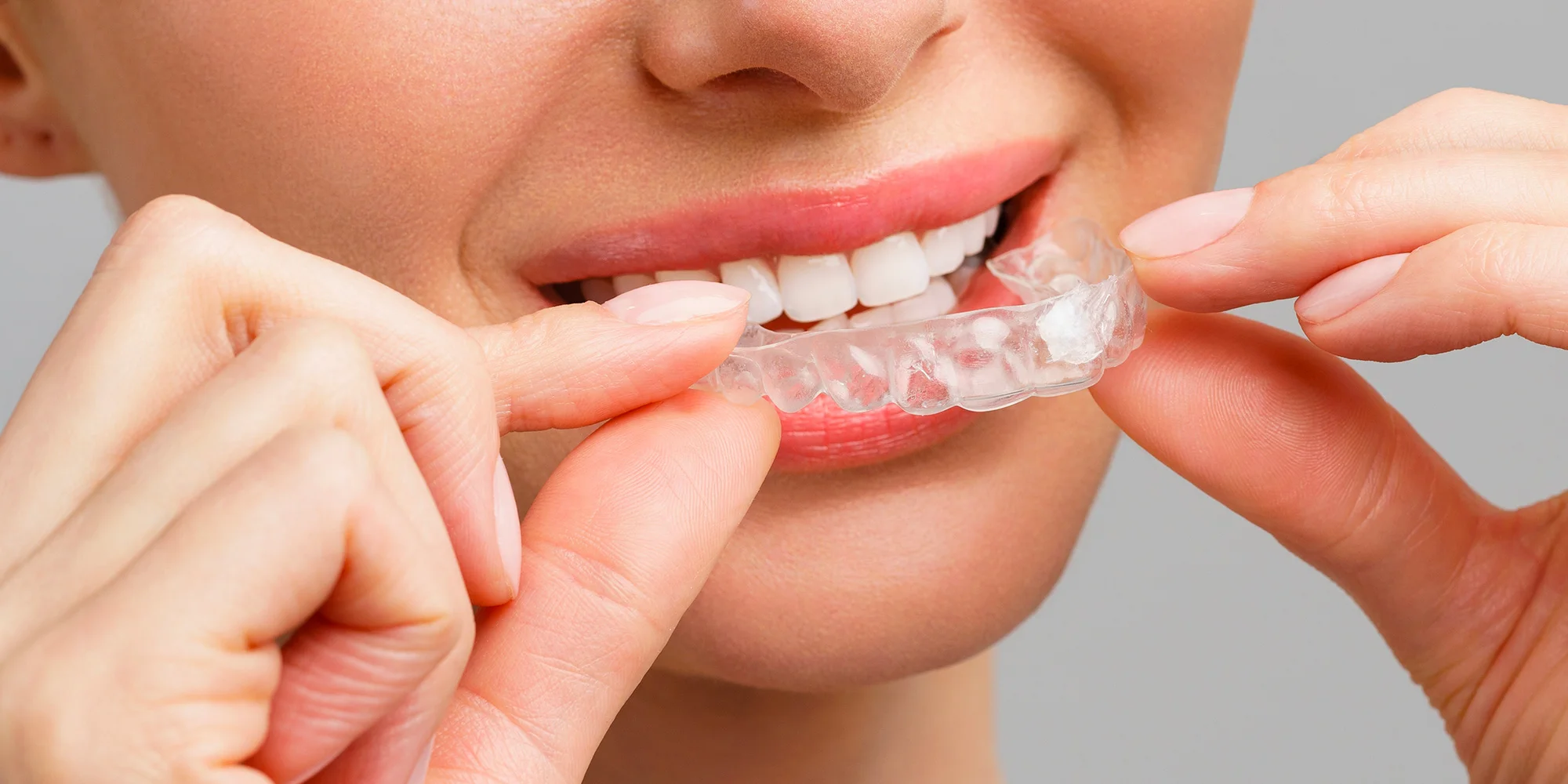 Dentální hygiena vč. pískování či domácí bělení zubů - Obrázek 4