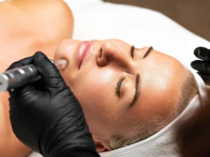 Kosmetické ošetření značky GIGI nebo mikrojehličkování