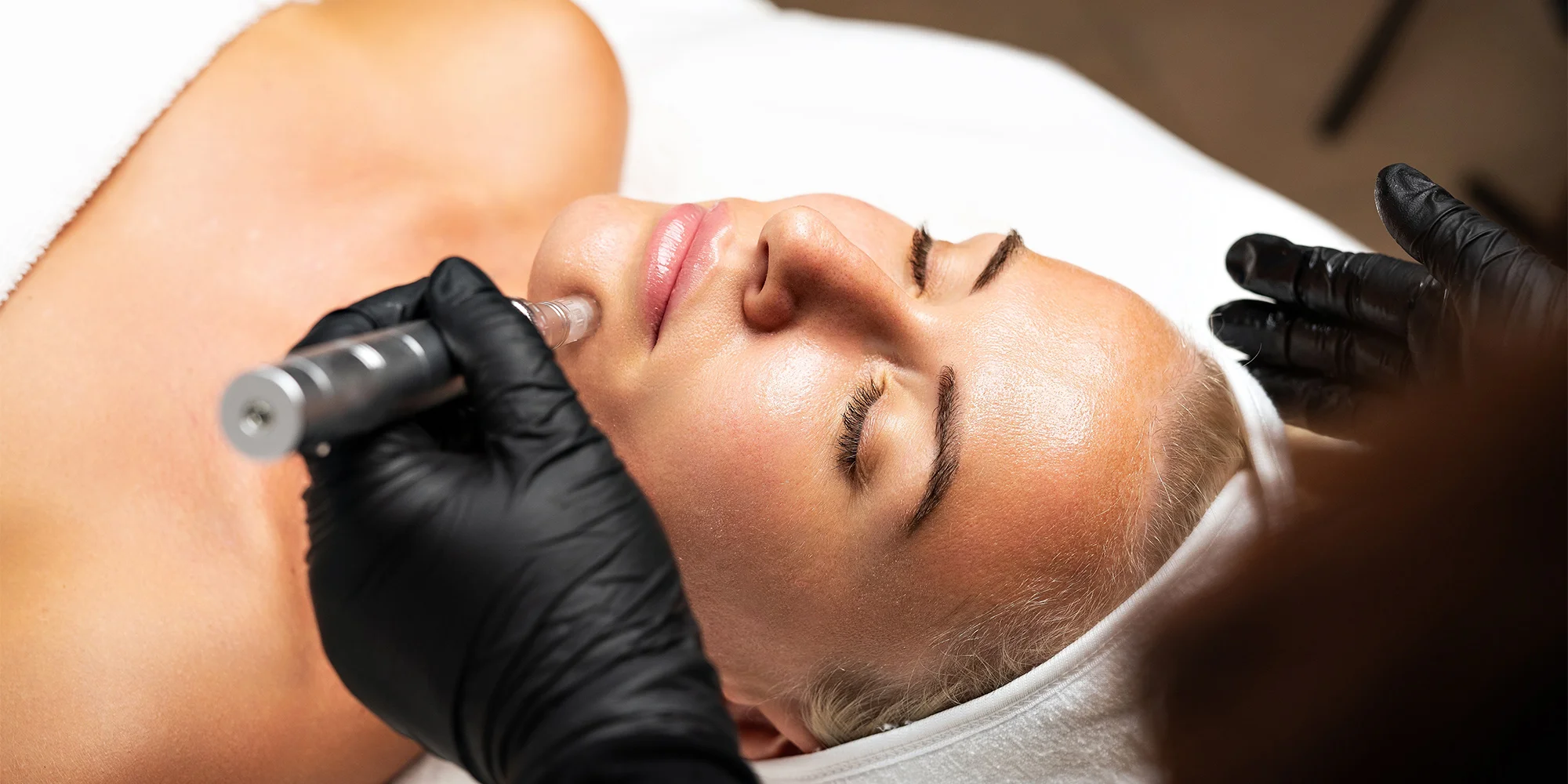 Kosmetické ošetření značky GIGI nebo mikrojehličkování