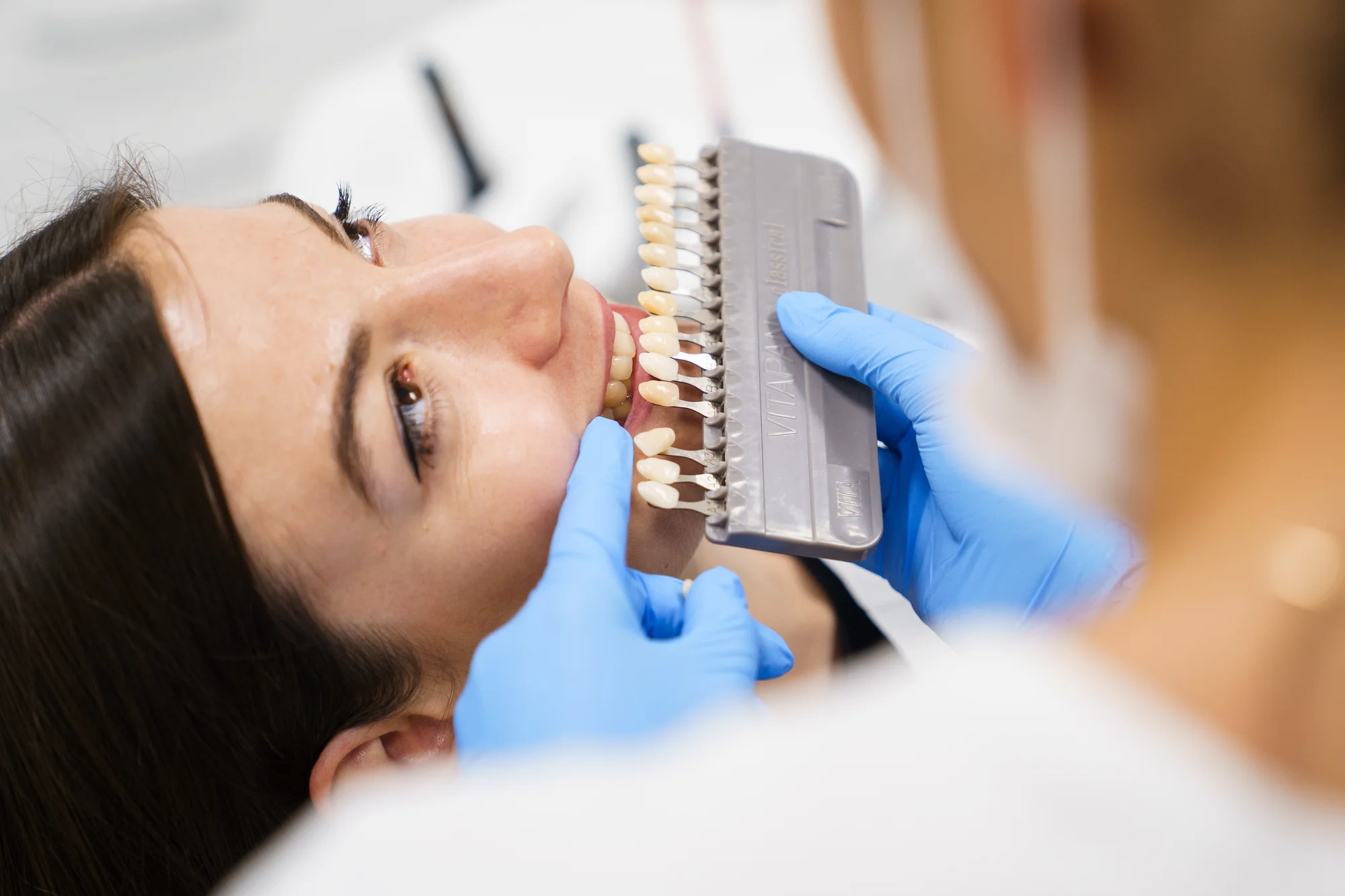 Ordinační bělení zubů LED lampou Philips Zoom - Obrázek 6