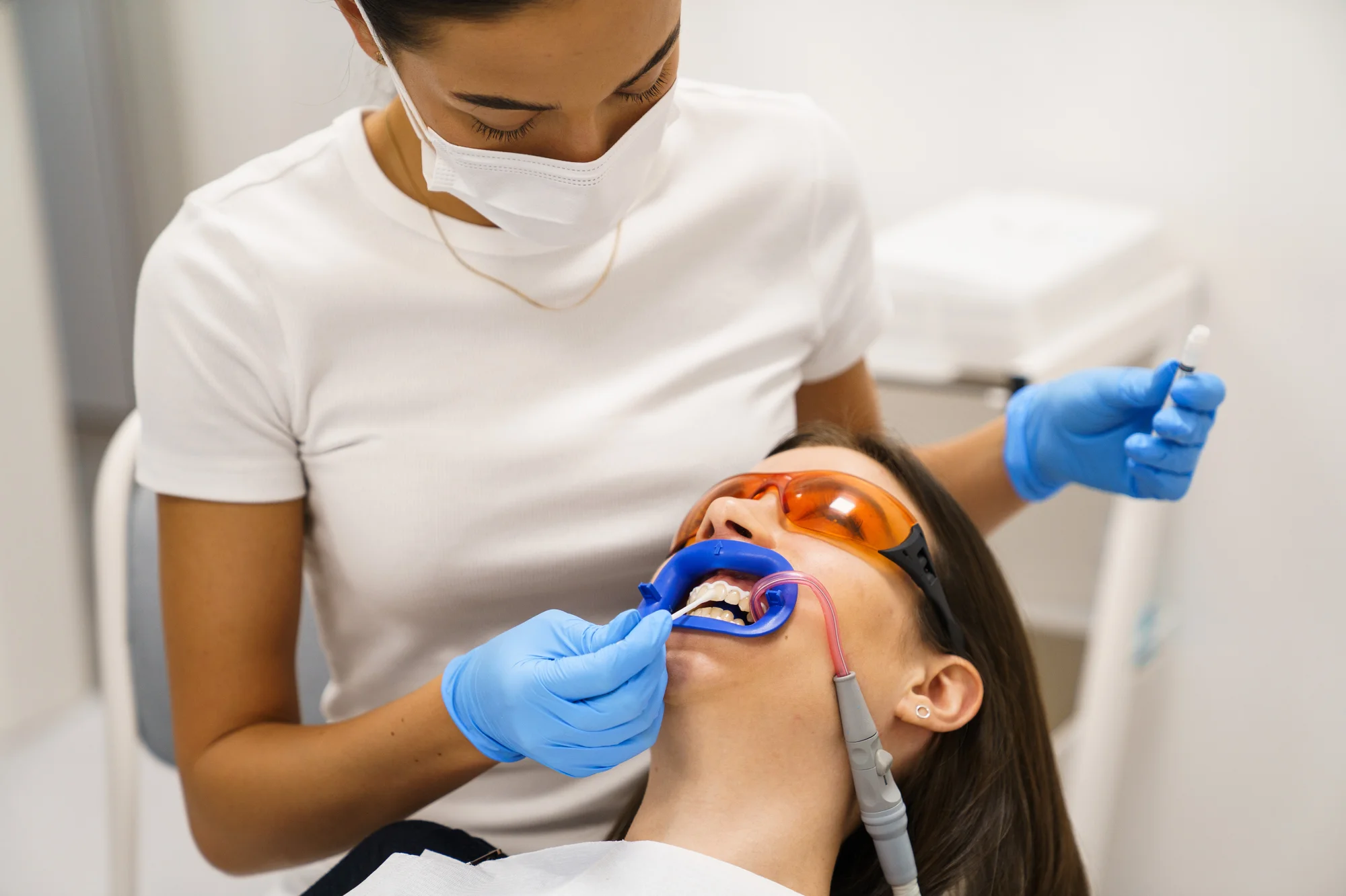 Ordinační bělení zubů LED lampou Philips Zoom - Obrázek 10