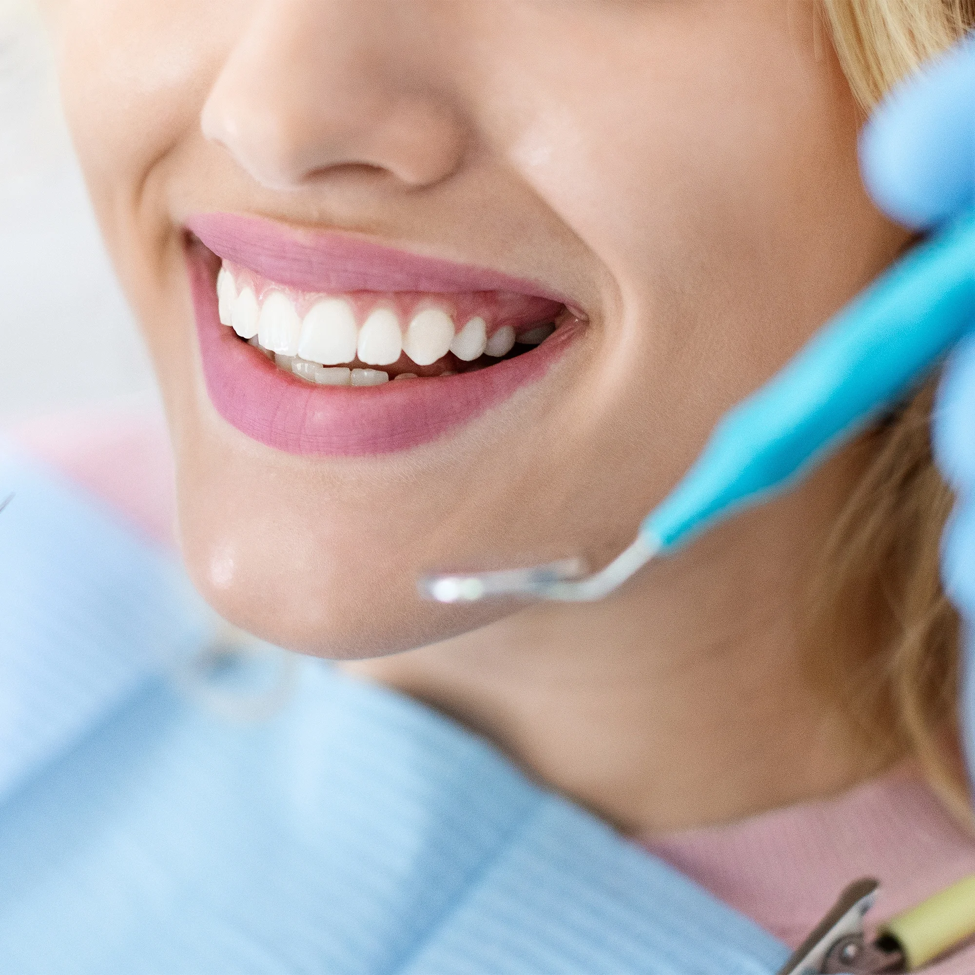 Dentální hygiena pro dospělé vč. air-flow a depurace - Obrázek 2