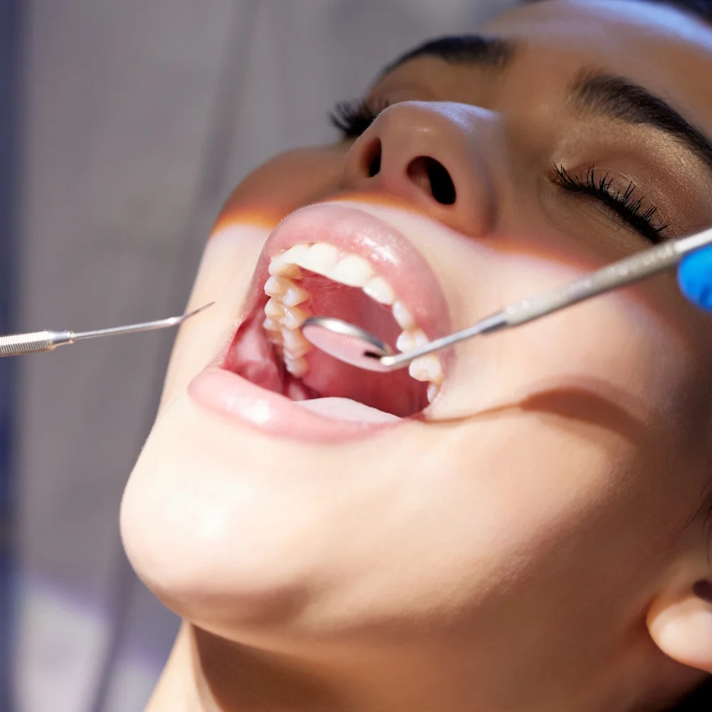 Dentální hygiena pro dospělé vč. lehkého bělení - Obrázek 2