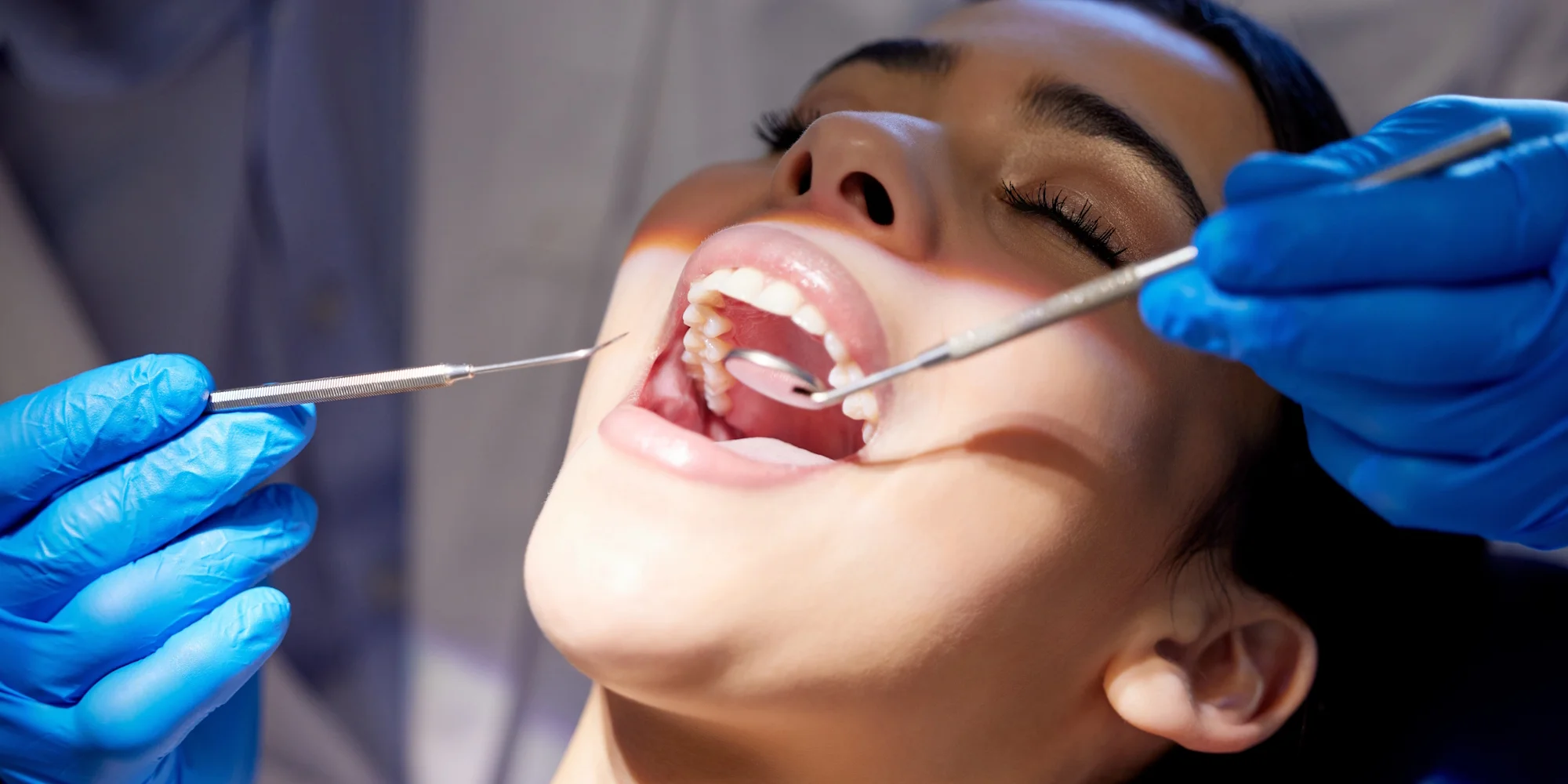 Dentální hygiena pro dospělé vč. lehkého bělení