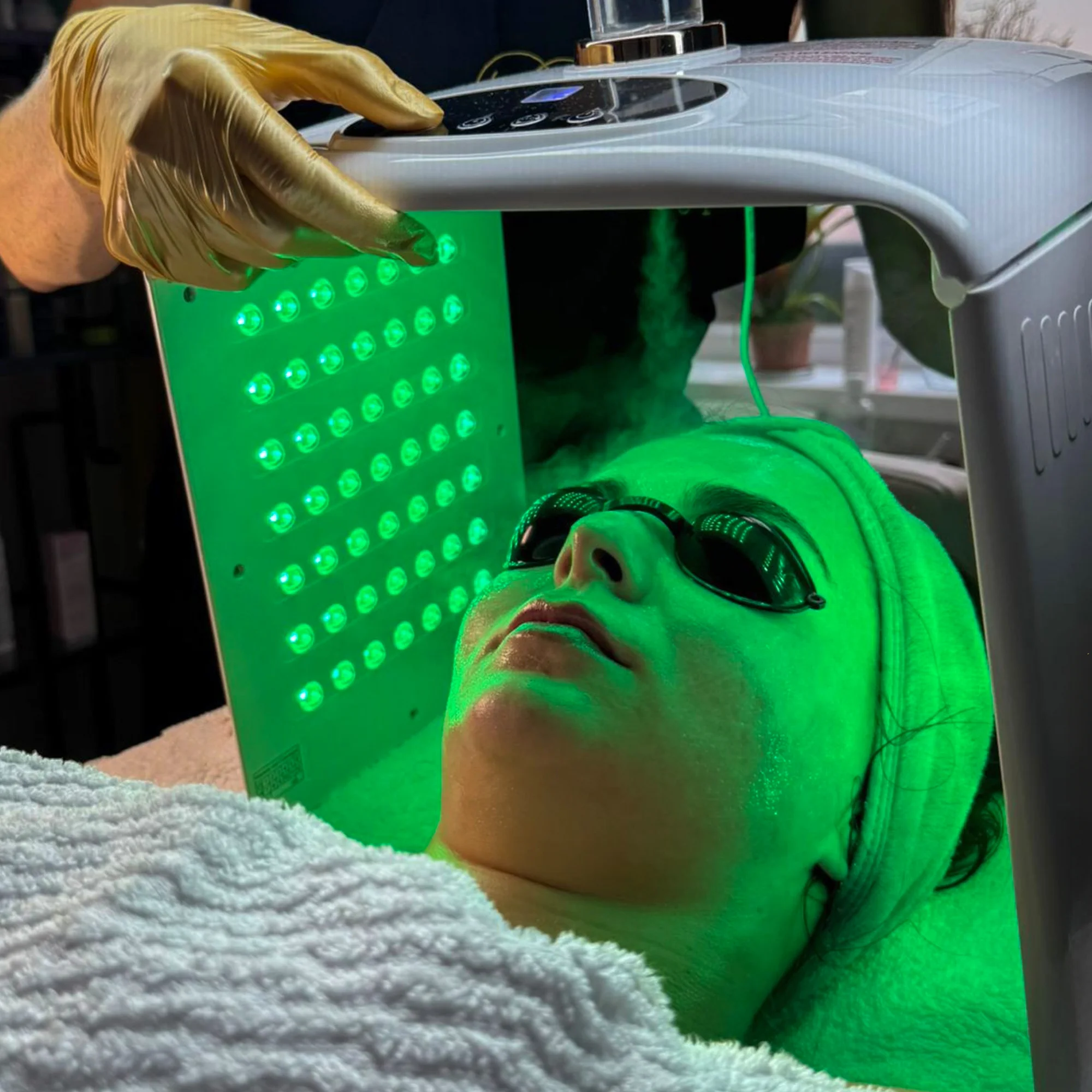 Kosmetické ošetření proti akné, vráskám i pigmentaci - Obrázek 2