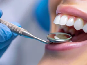 Dentální hygiena vč. leštění či air-flow a fluoridace