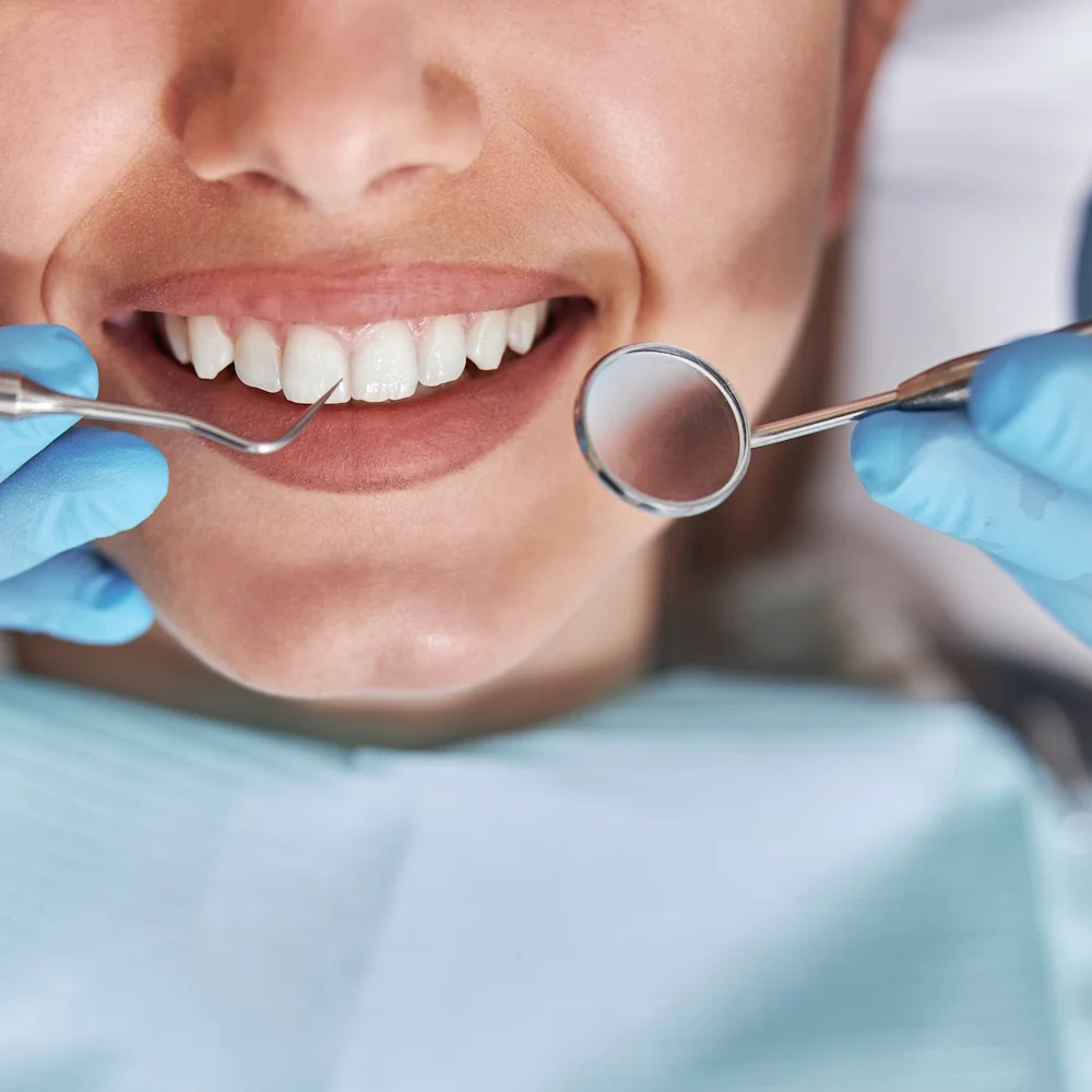 Dentální hygiena vč. pískování pro děti i dospělé - Obrázek 2