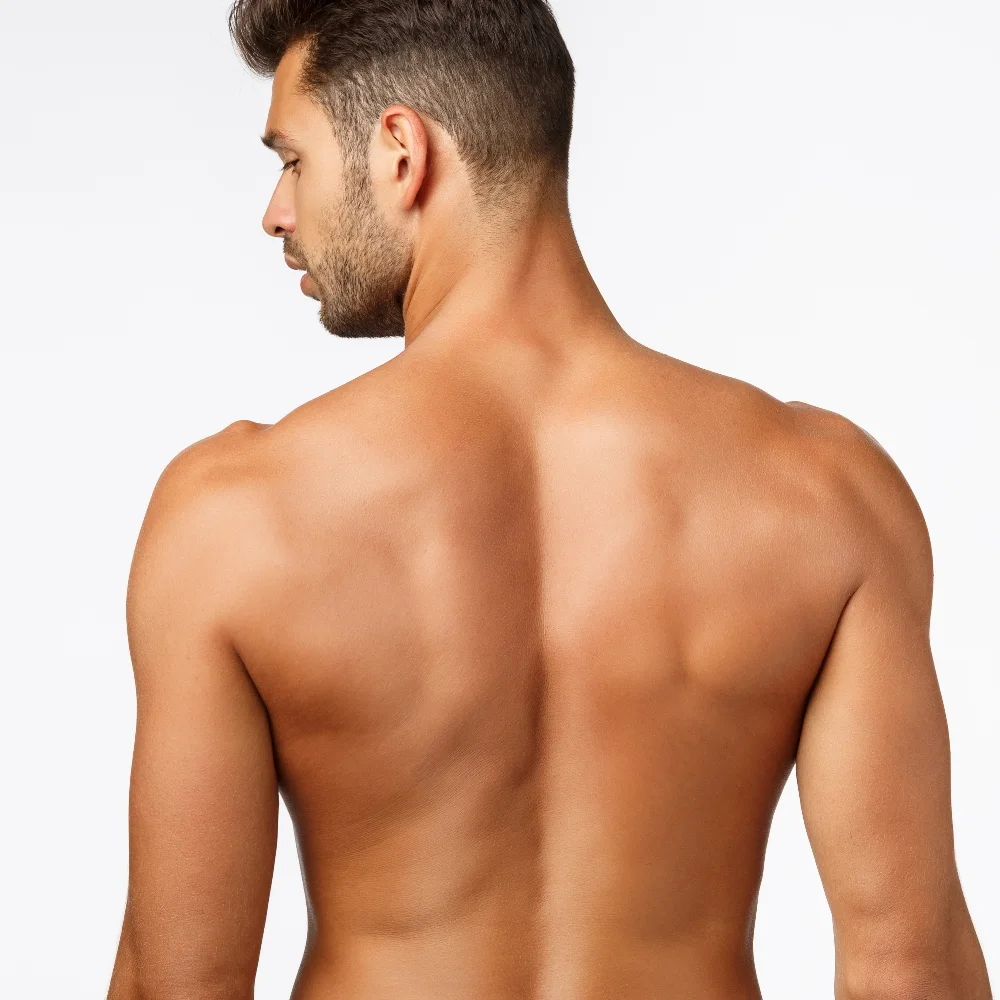 Zbavte se chloupků: trvalá epilace metodou FPL - Obrázek 2