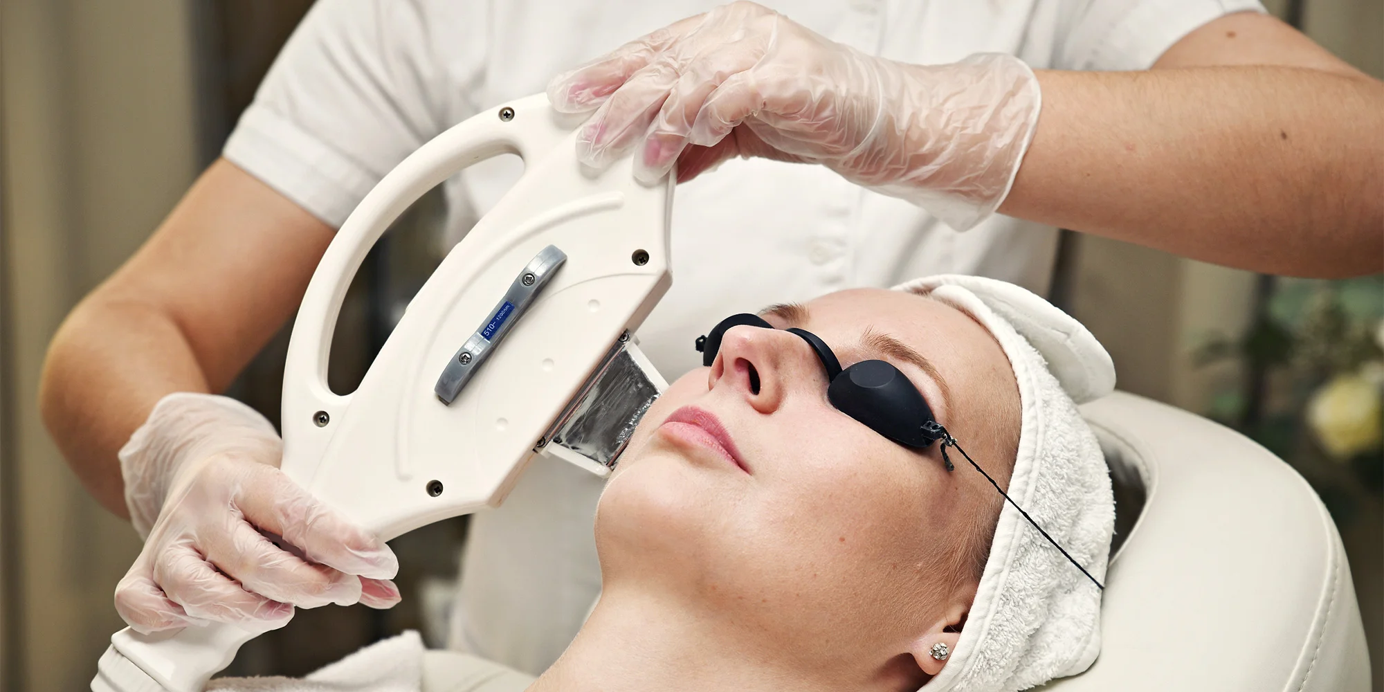 Pryč s chloupky: IPL epilace špičkovým přístrojem - Obrázek 4