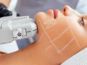 Omlazení pleti: Thermage či Hifu lifting obličeje i krku