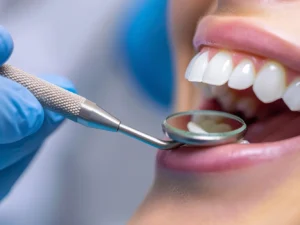 Vstříc zářivému úsměvu: dentální hygiena i ordinační bělení