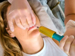 Krásné rty či pleť bez vrásek: jedno nebo dvě ošetření pomocí hyaluron pen
