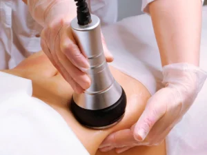 Ultrazvuková kavitace nebo radiofrekvence: revoluční metoda hubnutí, nebo vyhlazení vrásek