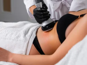 Kavitace pro štíhlejší postavu: laserová lipolýza oblasti dle výběru, 1 až 10 ošetření