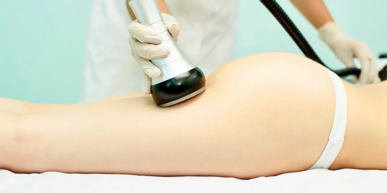 Štíhlejší a vytvarovaná postava: kavitace a lymfodrenáž, 1 až 3 ošetření