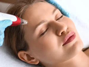 Kosmetické ošetření pleti i s masáží či mikrojehličkování pleti i dekoltu