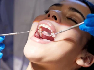 Pro zářivý úsměv a zdravý chrup: dentální hygiena včetně lehkého bělení zubů