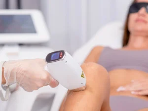 Laserová epilace vybraných partií: hladká pokožka nohou, rukou i obličeje